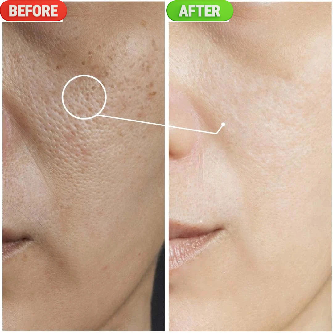 Glycolic-Bright Matte Luminizing Cream | Fades Dark Spots | 24H Oil Control | Instant Glass Glow