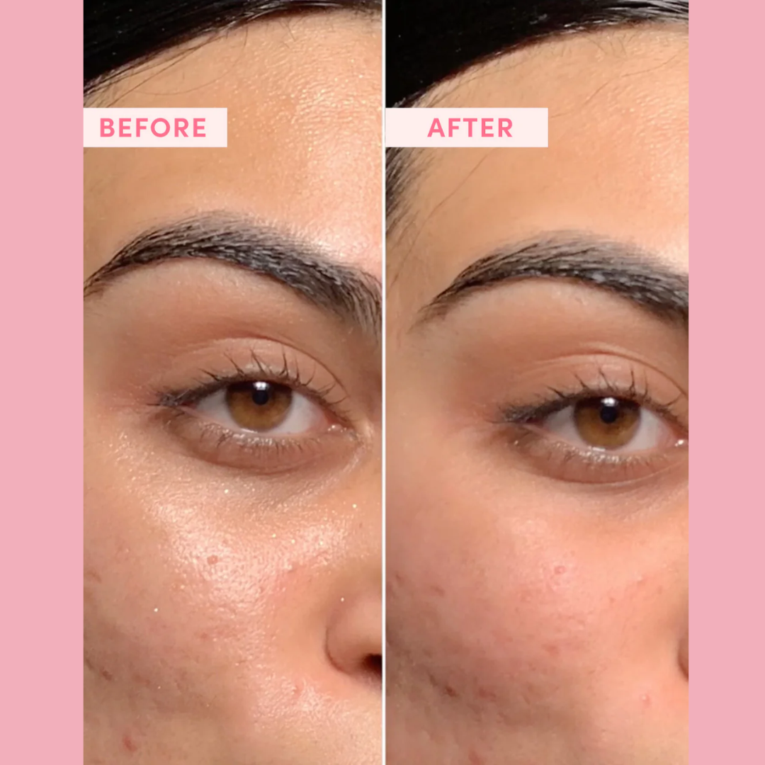 Enzyme Dead cell removal Scrub - Exfoliant | Clean Pores | Brightening | Skin Polishing | Texture Refining