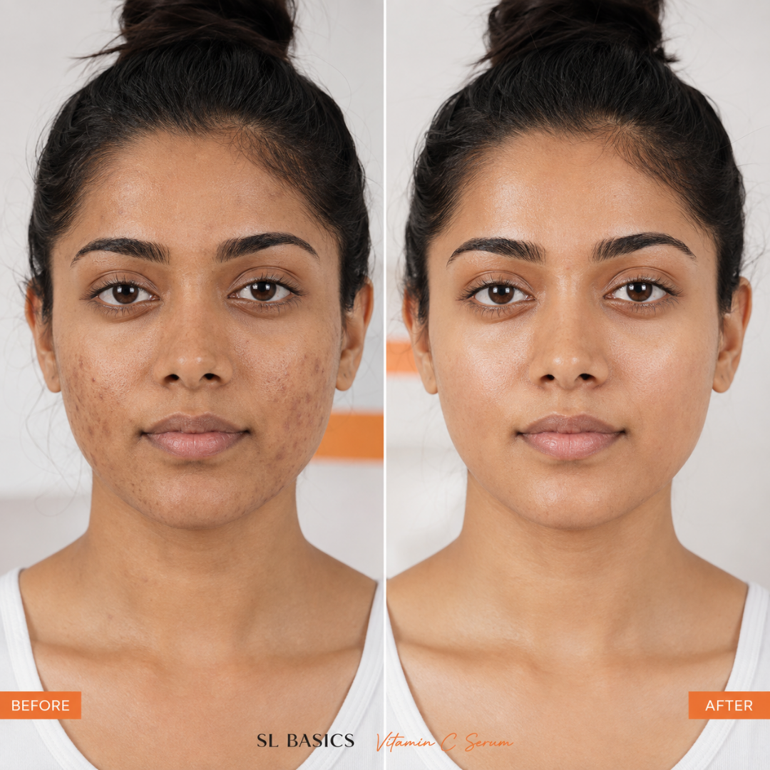 SL Basics Vitamin C Serum + Orange Radiance Cream Duo – 10% Stable Vitamin C Serum + Brightening Radiance Cream – For Spot-Free, Clear & Radiant Skin – Dark Spot Care, Tone Brightening & Deep Hydration