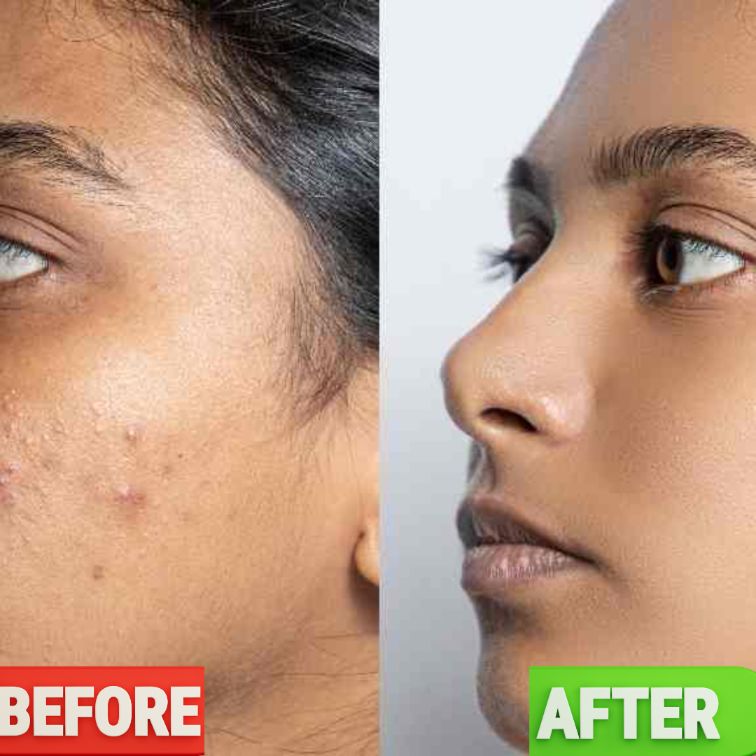 WishCare NMF Water Gel | Oil-Free Hydration | Calms Redness | Controls Excess Oil