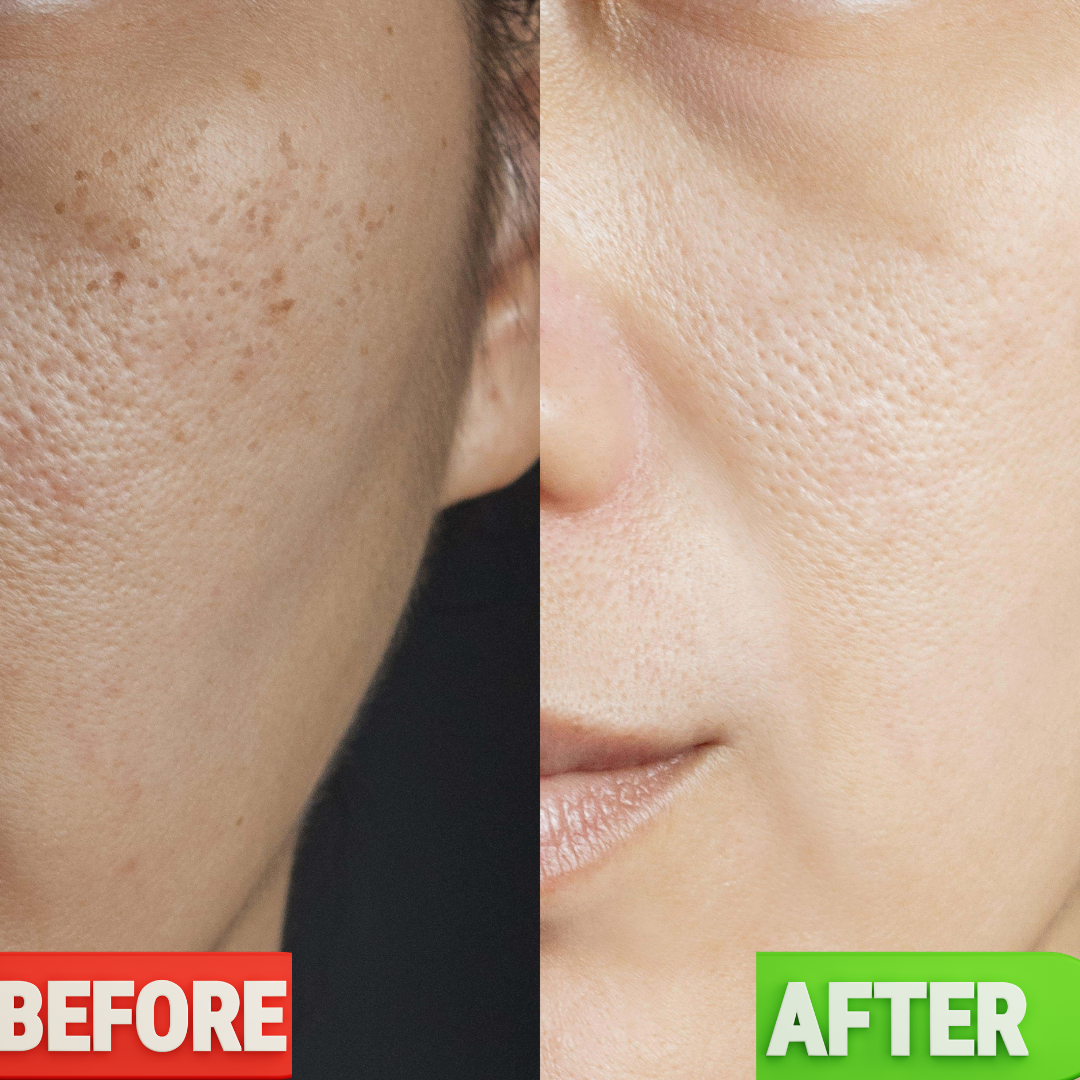 WishCare NMF Water Gel | Oil-Free Hydration | Calms Redness | Controls Excess Oil