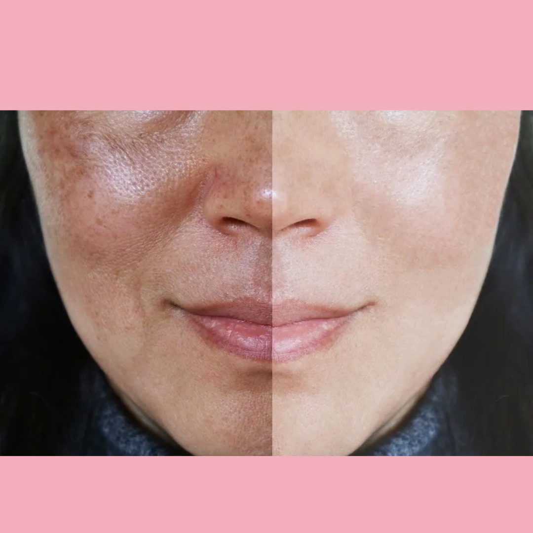 Enzyme Dead cell removal Scrub - Exfoliant | Clean Pores | Brightening | Skin Polishing | Texture Refining