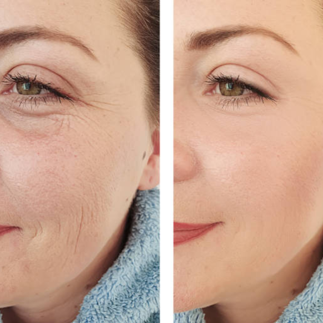 PD3 Regenerating Cream Max – Advanced PDRN Cream – Repair, Rebuild & Rejuvenate – Acne Scars & Skin Barrier Repair