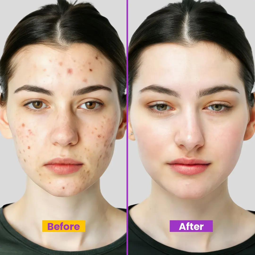 Glycolic-Bright Matte Luminizing Cream | Fades Dark Spots | 24H Oil Control | Instant Glass Glow