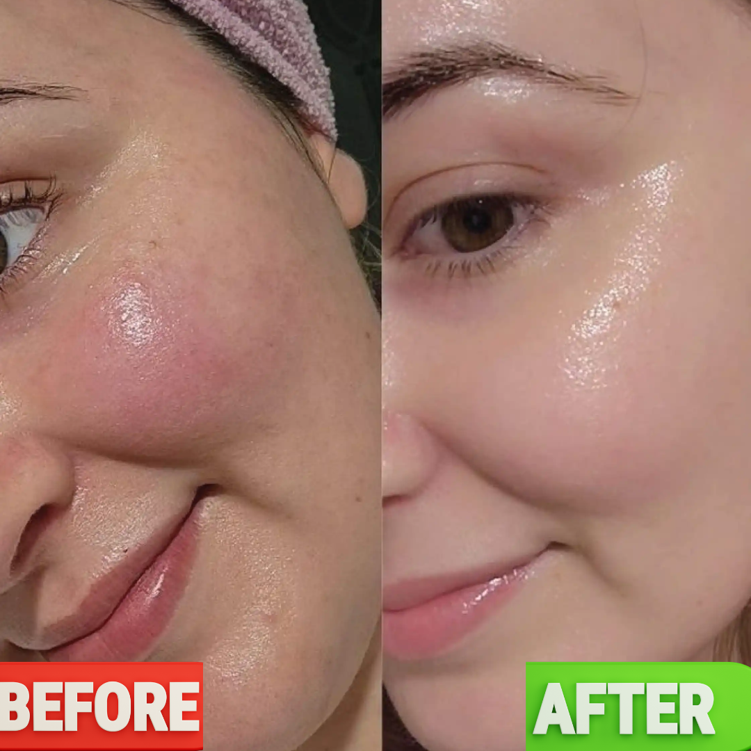WishCare NMF Water Gel | Oil-Free Hydration | Calms Redness | Controls Excess Oil
