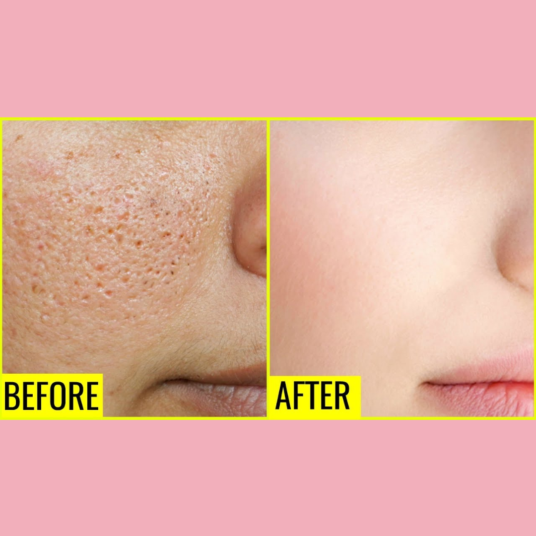 Enzyme Dead cell removal Scrub - Exfoliant | Clean Pores | Brightening | Skin Polishing | Texture Refining