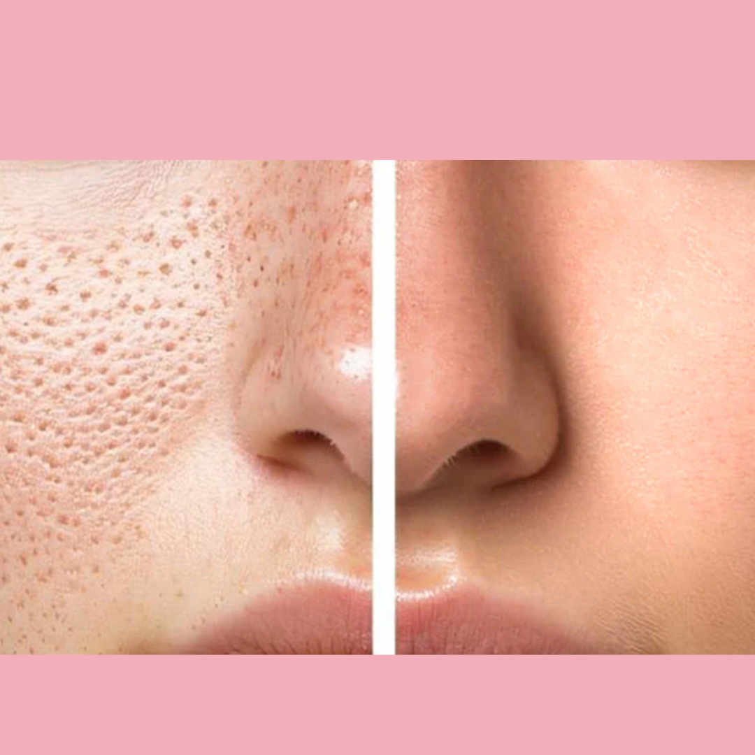 Enzyme Dead cell removal Scrub - Exfoliant | Clean Pores | Brightening | Skin Polishing | Texture Refining