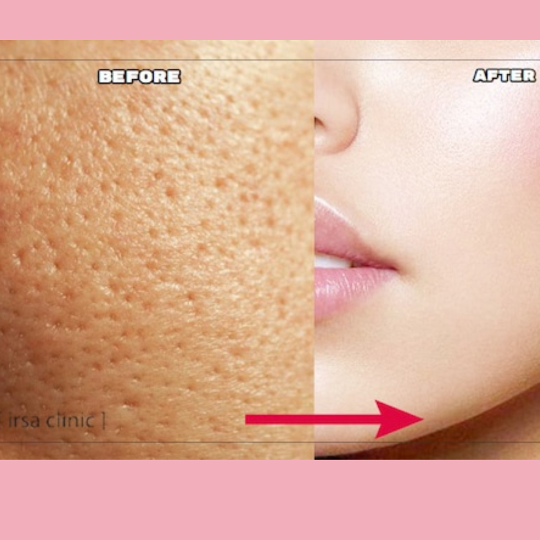 Enzyme Dead cell removal Scrub - Exfoliant | Clean Pores | Brightening | Skin Polishing | Texture Refining