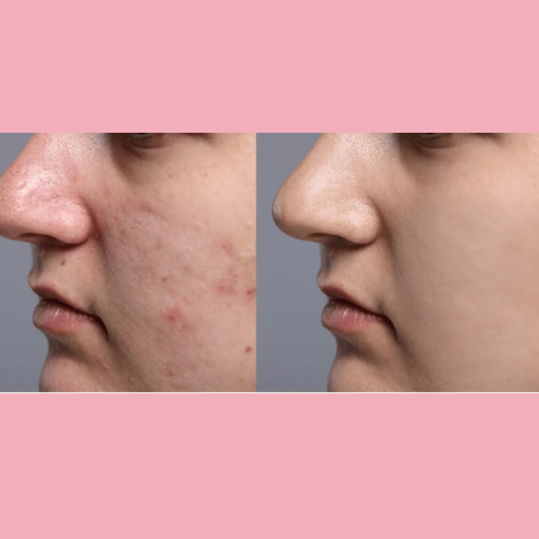 Enzyme Dead cell removal Scrub - Exfoliant | Clean Pores | Brightening | Skin Polishing | Texture Refining