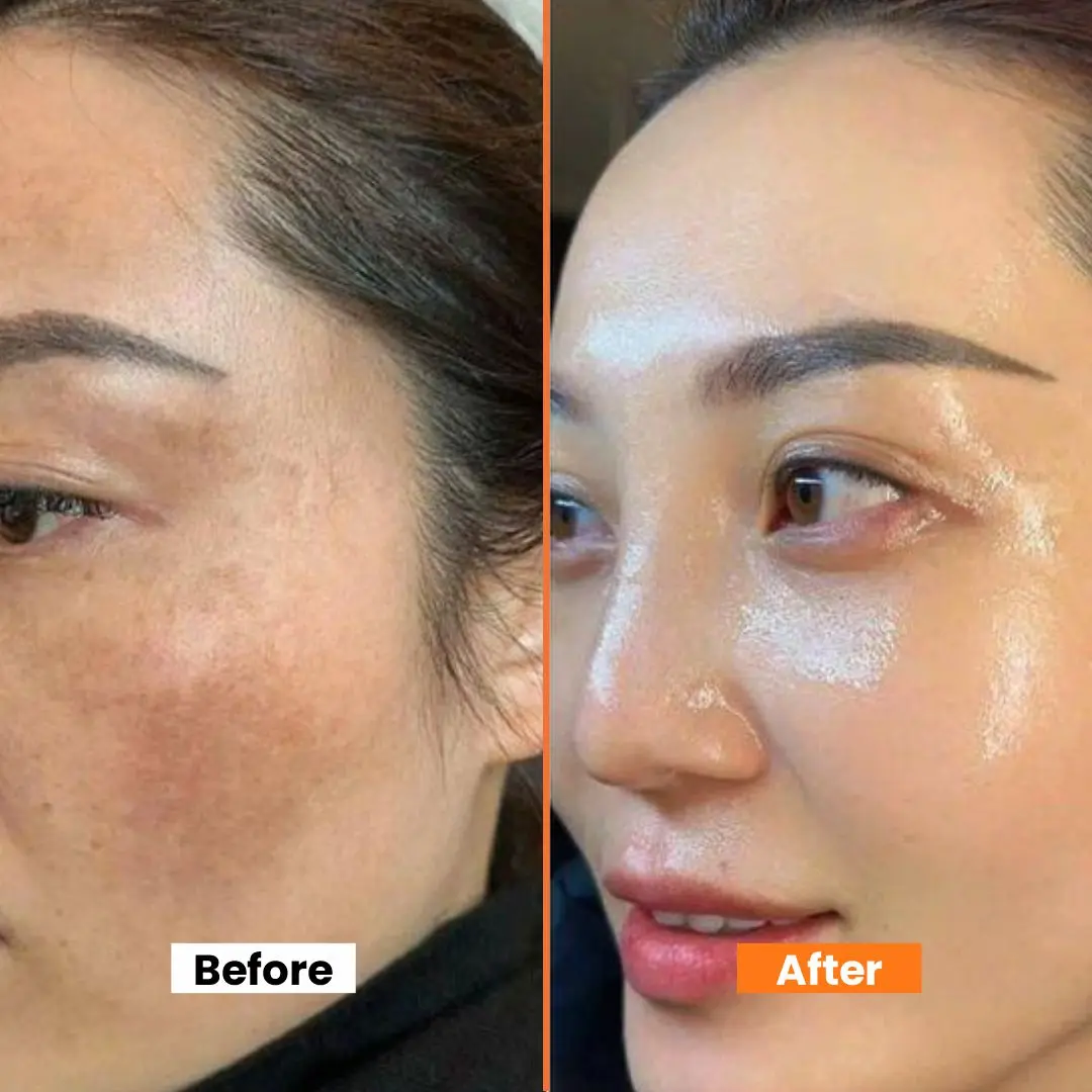 WishCare NMF Water Gel | Oil-Free Hydration | Calms Redness | Controls Excess Oil