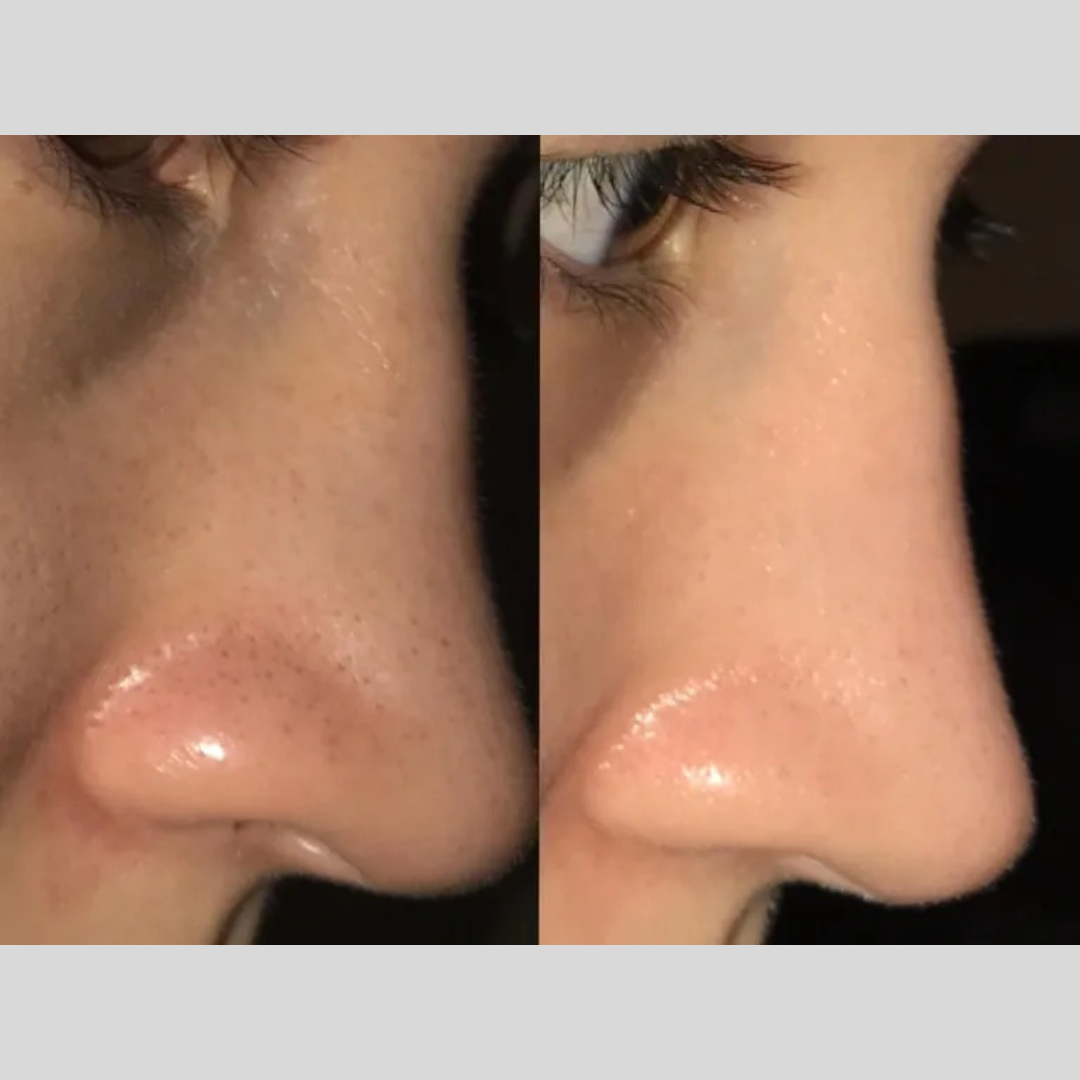 Enzyme Dead cell removal Scrub - Exfoliant | Clean Pores | Brightening | Skin Polishing | Texture Refining