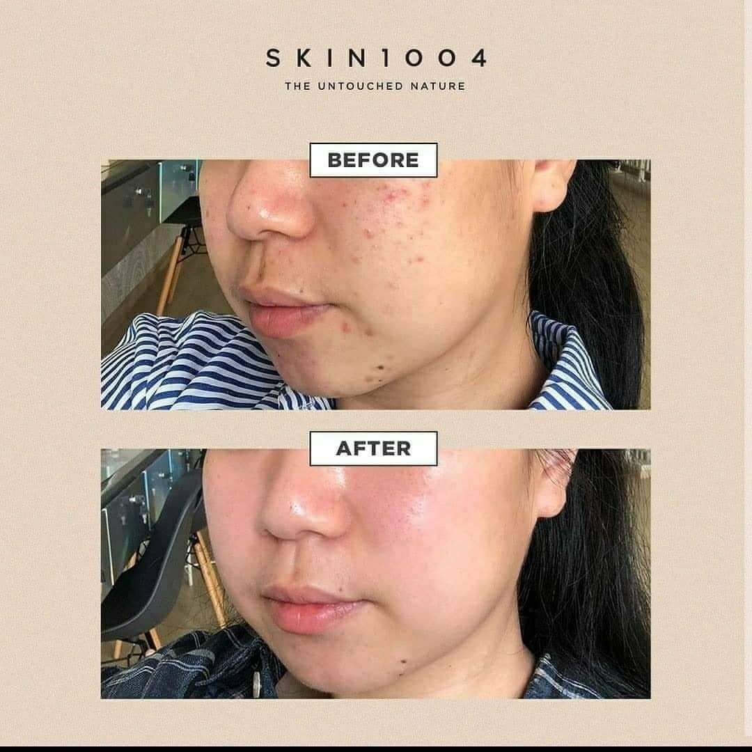 SKIN1004 Madagascar Centella Tone Brightening Capsule Ampoule