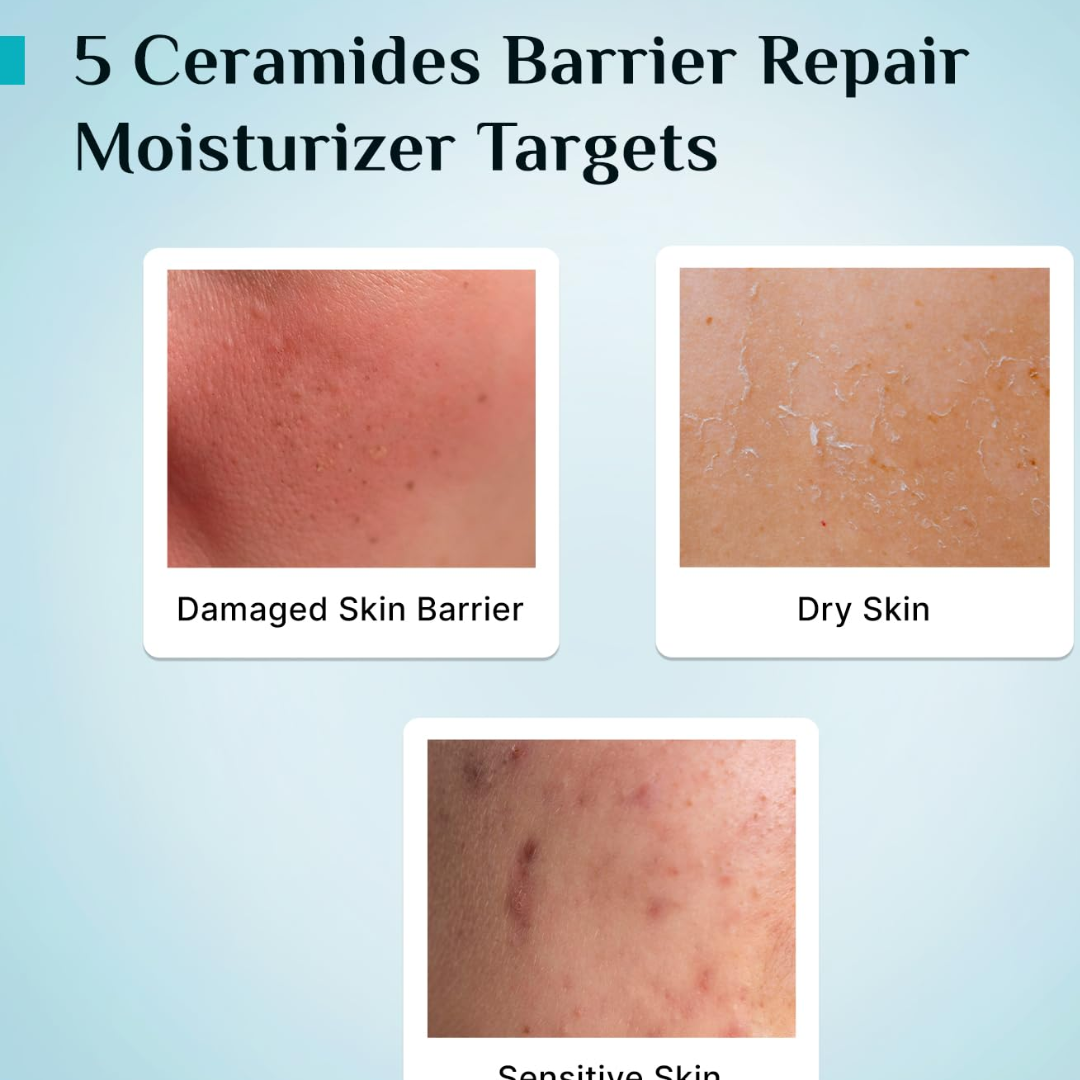 Pilgrim Barrier Repair Moisturizer | Intense Hydration for Dry, Damaged & Sensitive Skin