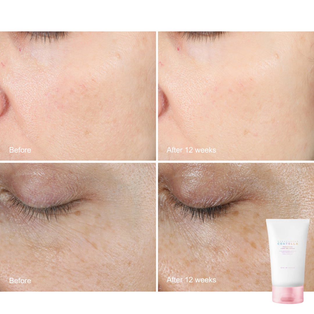 Centella Light Pore-Refining Gel Cream