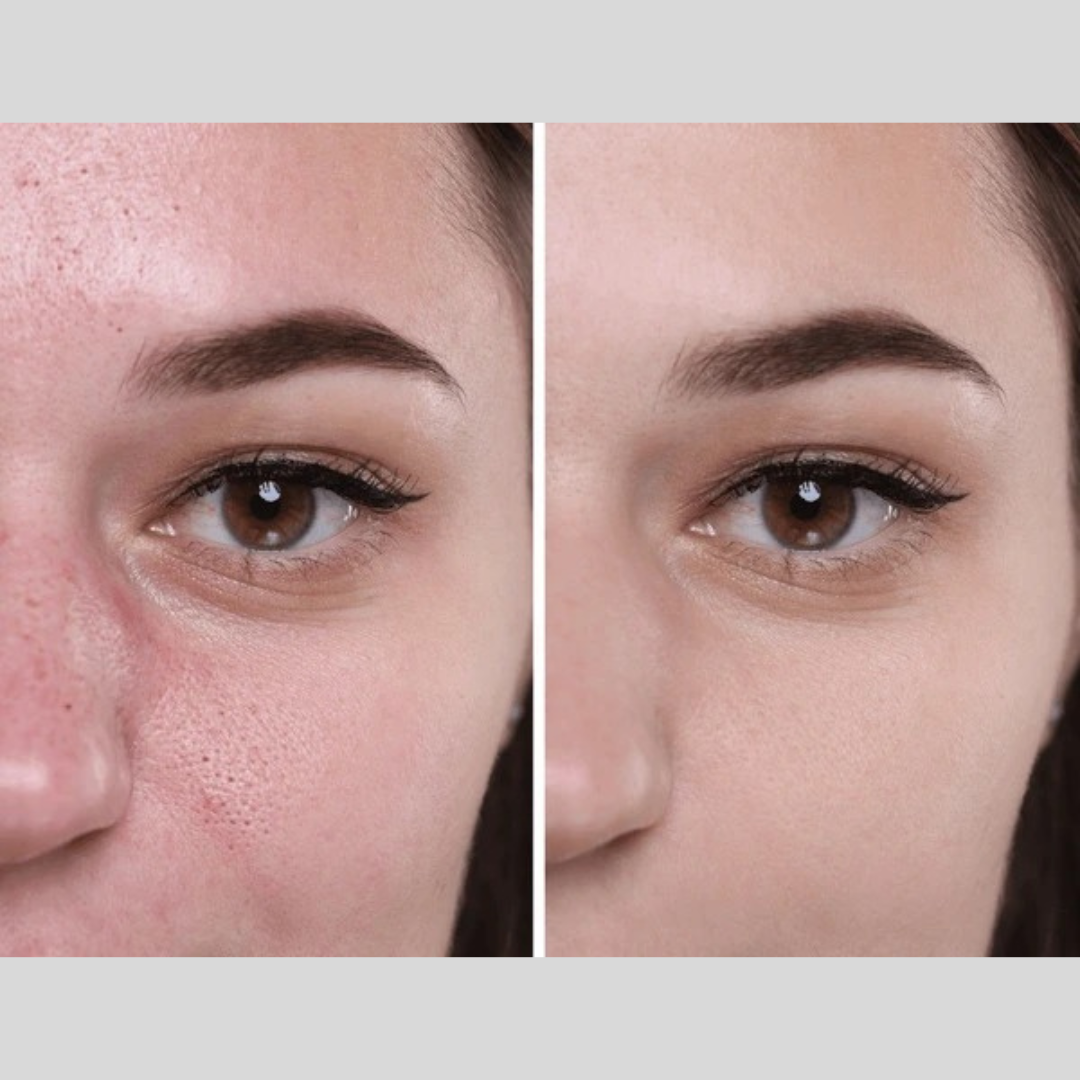 Enzyme Dead cell removal Scrub - Exfoliant | Clean Pores | Brightening | Skin Polishing | Texture Refining