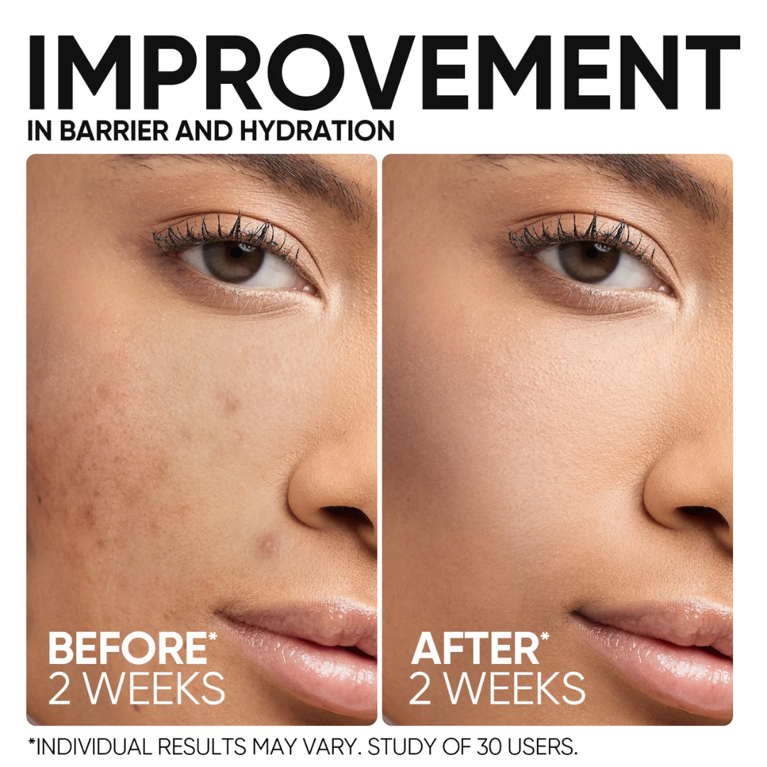 Pilgrim Barrier Repair Moisturizer | Intense Hydration for Dry, Damaged & Sensitive Skin