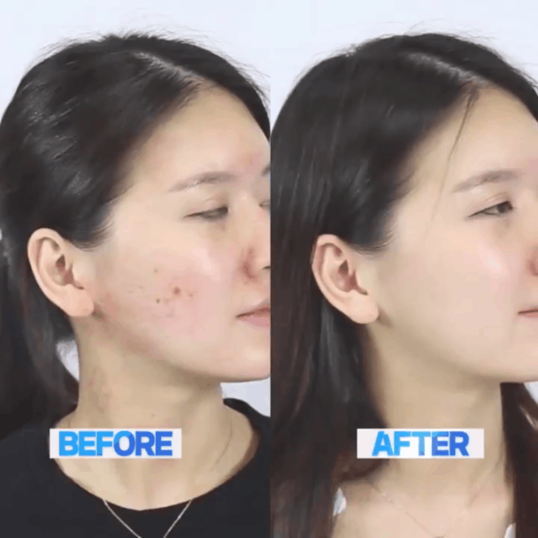 Centella Light Pore-Refining Gel Cream