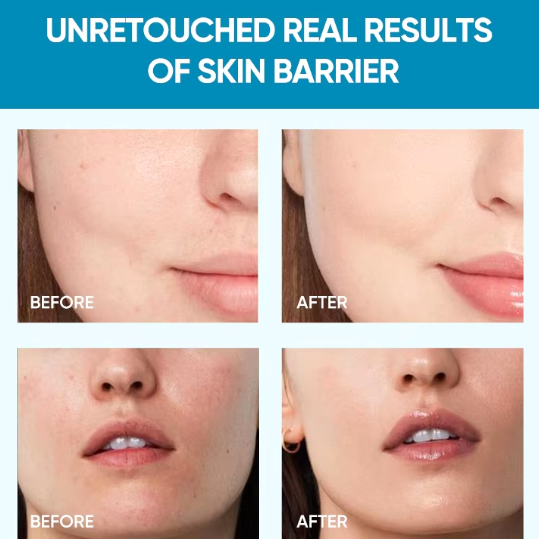 Pilgrim Barrier Repair Moisturizer | Intense Hydration for Dry, Damaged & Sensitive Skin