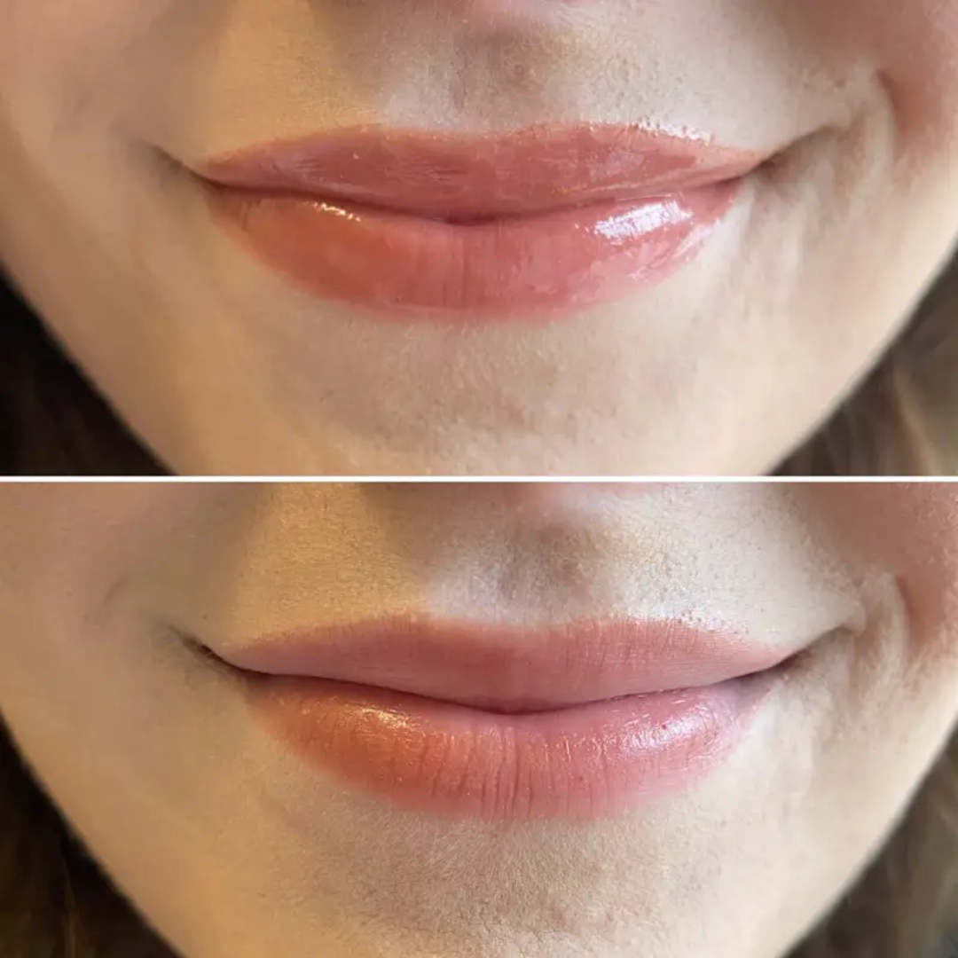 Lamel Stain Hydrating Lip Gloss | 2-in-1 Gloss & Long-Lasting Lip Stain