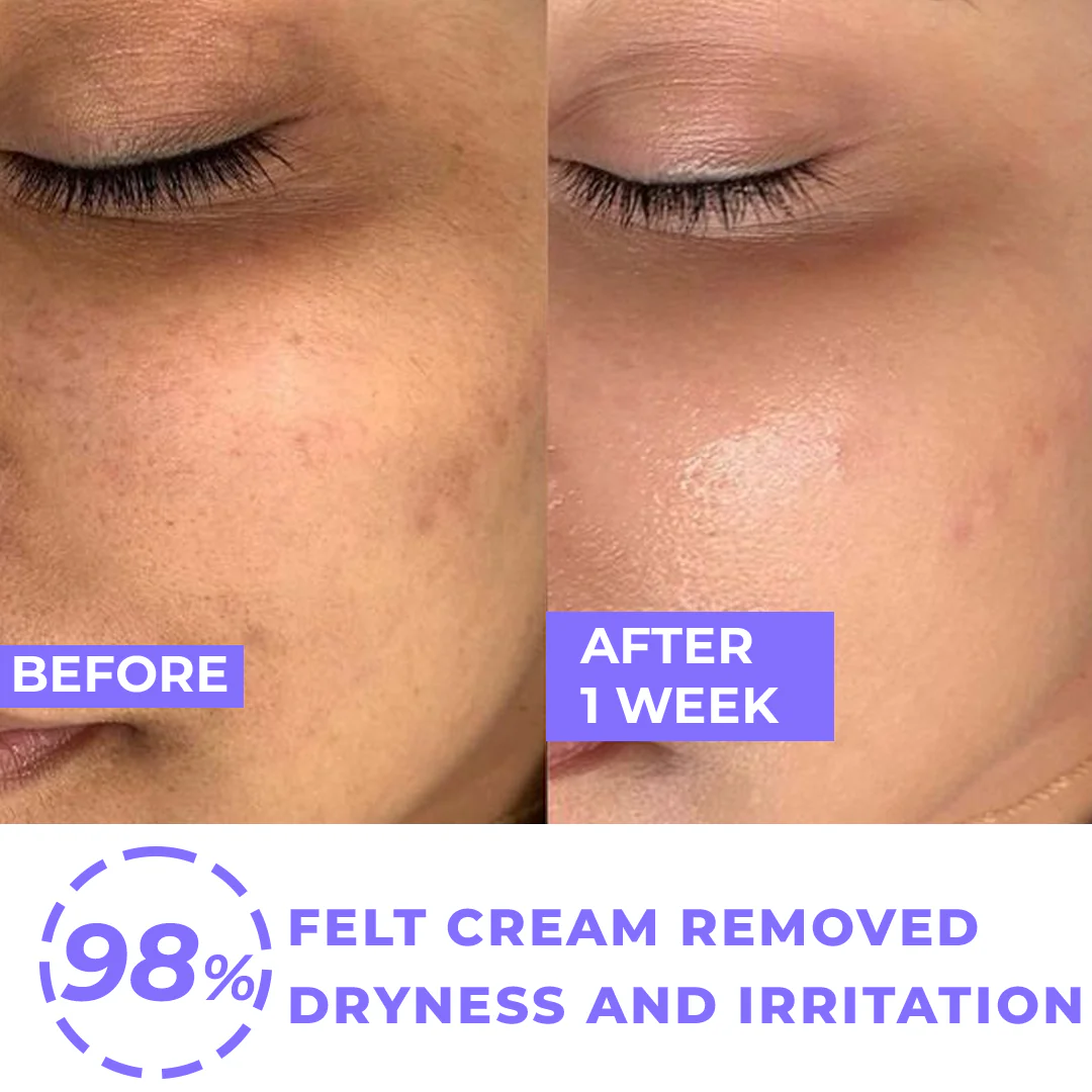 Simple Hydrating Light Moisturiser | 12-Hour Moisture, Vitamin B5+E & Niacinamide, for Sensitive Skin
