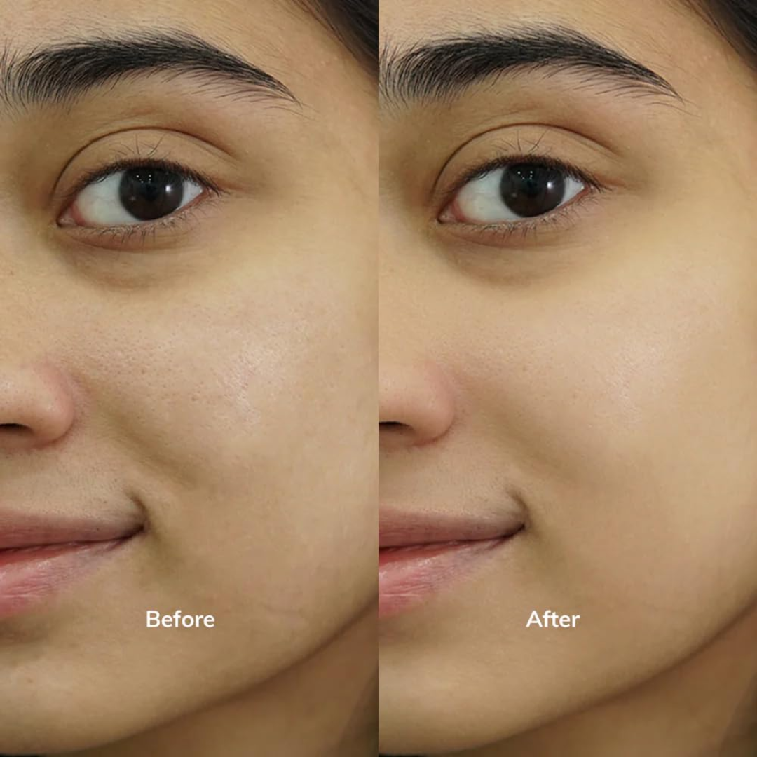 Enzyme Dead cell removal Scrub - Exfoliant | Clean Pores | Brightening | Skin Polishing | Texture Refining