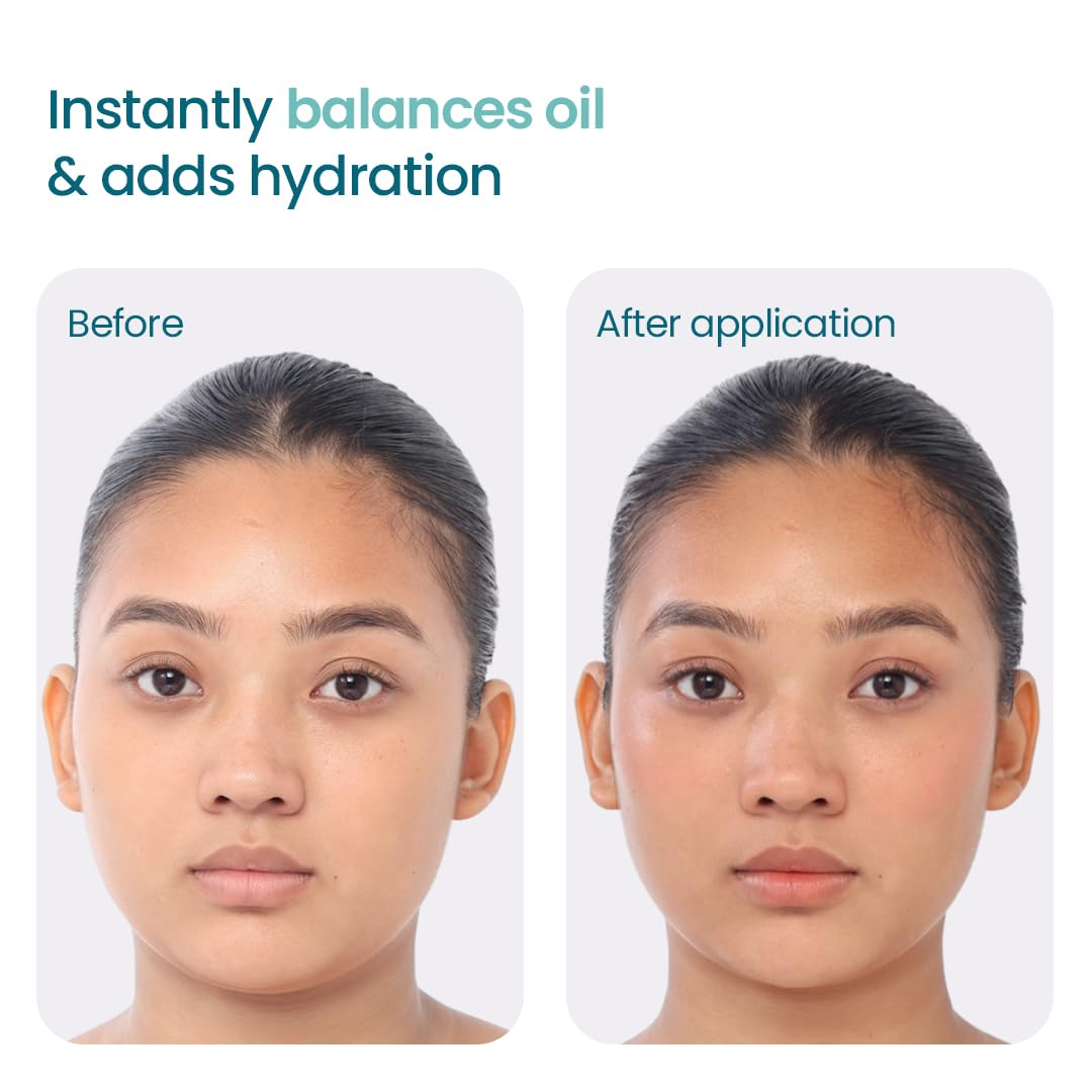 WishCare NMF Water Gel | Oil-Free Hydration | Calms Redness | Controls Excess Oil