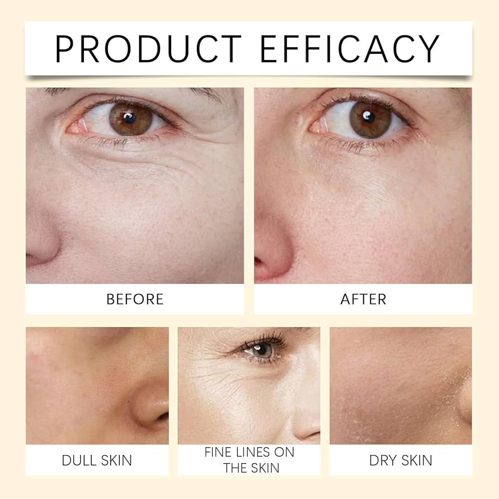 Mandelic Clear Brightening Cream For Anti-Aging & Brightens Skin