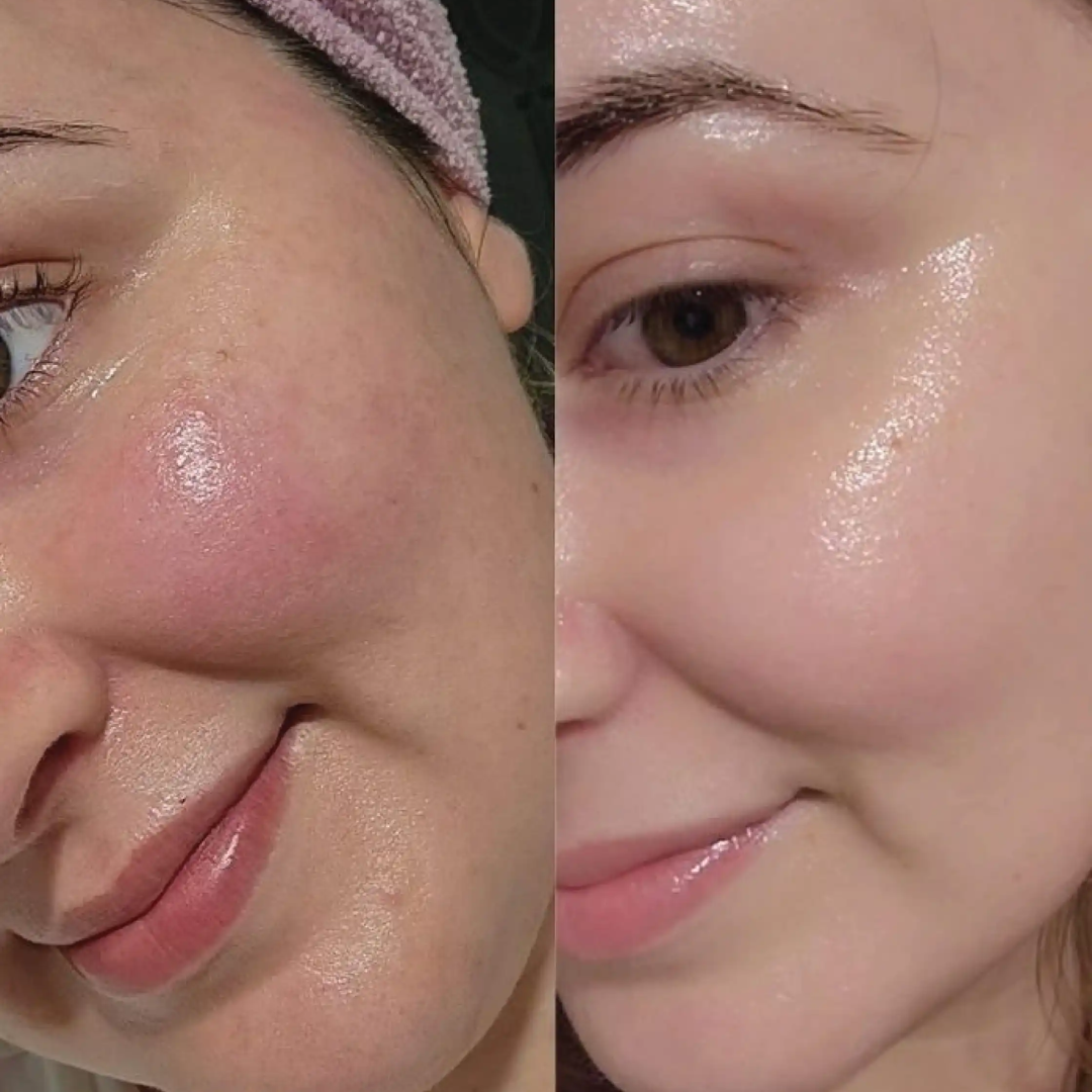 Glycolic-Bright Matte Luminizing Cream | Fades Dark Spots | 24H Oil Control | Instant Glass Glow