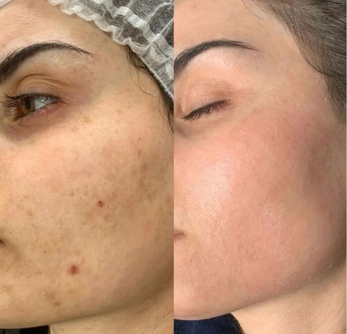 Mandelic Clear Brightening Cream For Anti-Aging & Brightens Skin